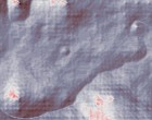 autismus asthma