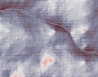 autismus muenchen