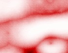 fortes autismus