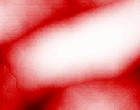 serotonin autismus