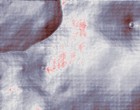 autismus mutismus