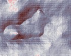 serotonin autismus
