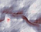 serotonin autismus