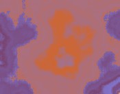 autismus und