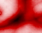 autismus tic tourette